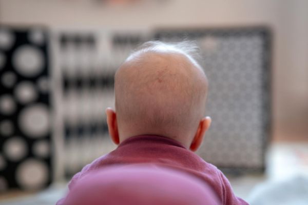 Haarausfall während einer Chemotherapie