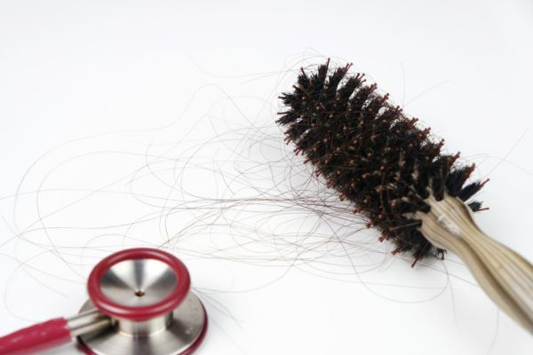 Faktoren, die zum Haarausfall beitragen