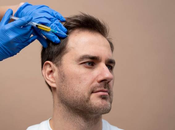 Mann, der sich einer Spanier Haartransplantation unterzieht