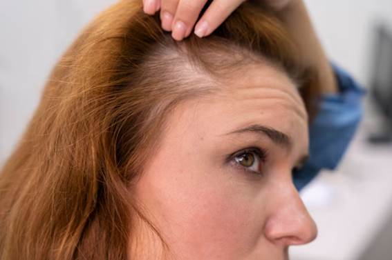 Diagnose und Behandlung von Alopezie