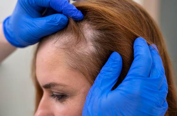 Ist Haarausfall normal oder ein Warnsignal?