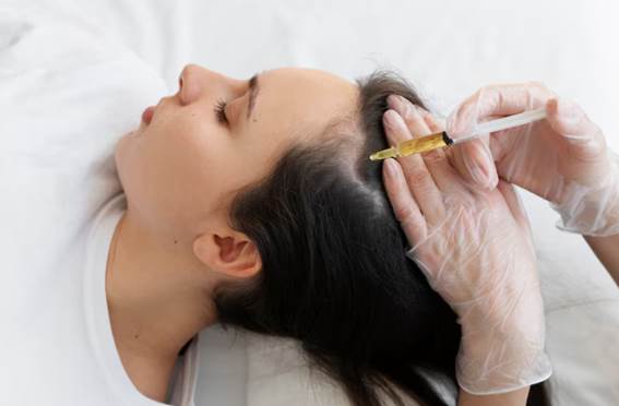 Professionelle Behandlungen In welchem Alter beginnt normalerweise der Haarausfall