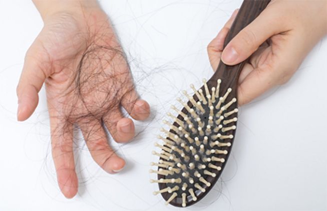 hair loss childbirth
