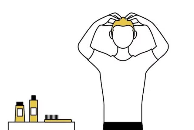 Figur eines Mannes, der sein Haar massiert, um es nach einer Haartransplantation zu stärken