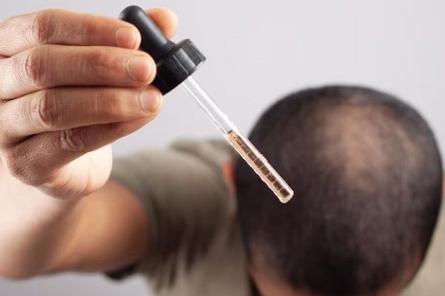 Mann zeigt Tropfer mit Haarwuchsmittel