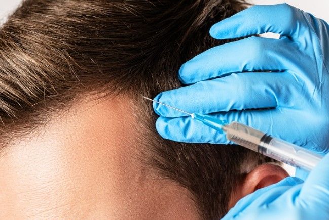 Platelet-Rich Plasma