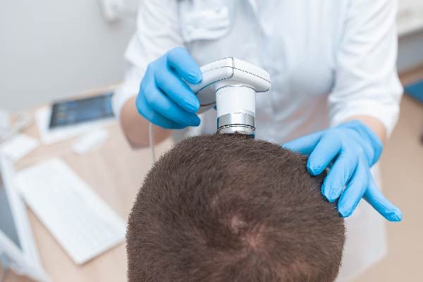 eine Stammzellbehandlung bei Haarausfall