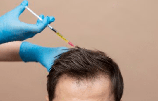 Haartransplantation auf dem Kopf eines Mannes zu vernünftigen Kosten