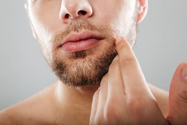 Arten von Barttransplantationen