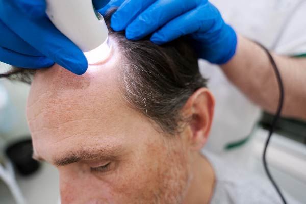 Ergebnisse der Mesotherapie für das Haar