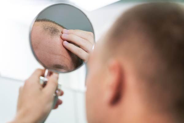 Was kostet eine Haartransplantation