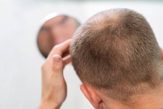 Wie ist die postoperative Pflege, um die Haartransplantation verbergen?