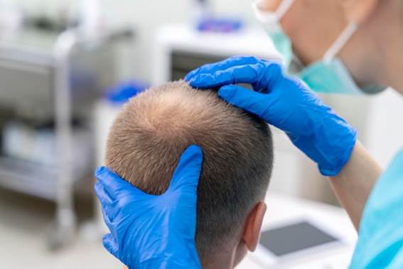 Arzt inspiziert die Kopfhaut des Patienten