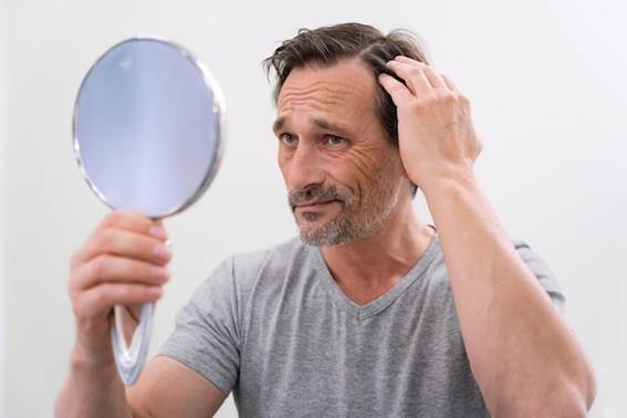 Mann sieht besorgt über Haarausfall aus Haartransplantation kosten Türkei