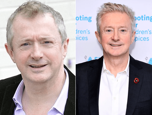 Louis Walsh Prominente, die eine Haartransplantation hatten 