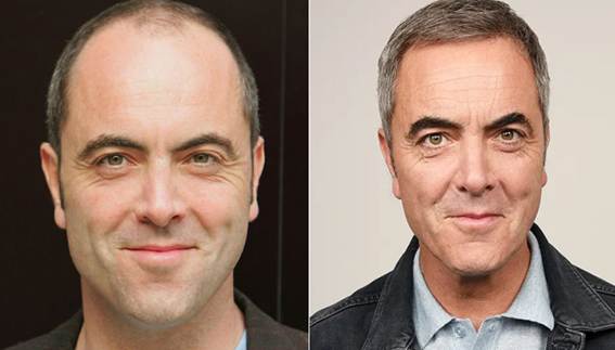 James Nesbitt die eine Haartransplantation hatten