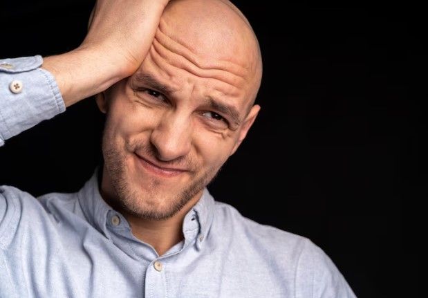 Mann nimmt seinen Kopf als Zeichen einer psychologischen Konsequenzen Alopezie